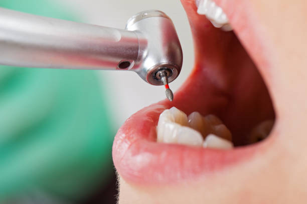 Best Root Canal Emergency Dentist  in South Shore, KY